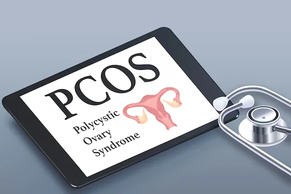 PCOS and PCOD Treatment